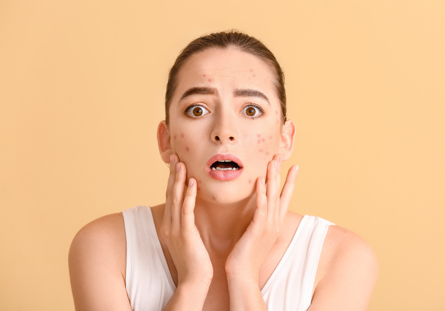 The Ultimate Guide to Fungal Acne-Safe Korean Skincare