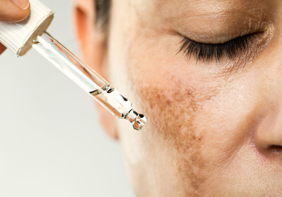 Best Korean Skincare for Hyperpigmentation (2025 Favourites)